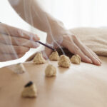 Women,Who,Are,Prescribed,The,Moxibustion,On,The,Back,In